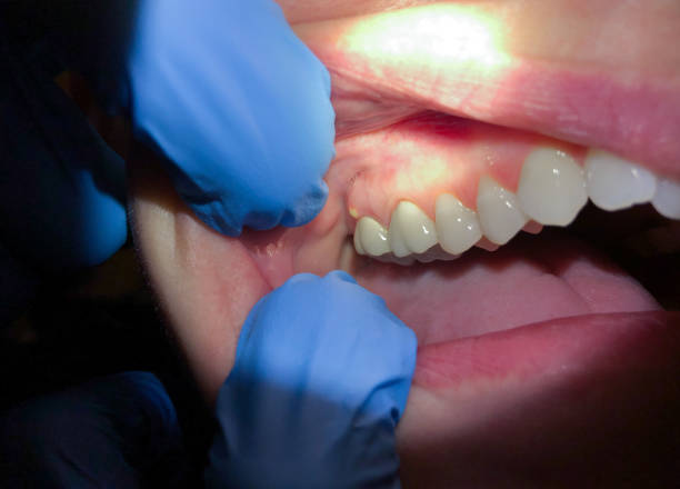 Best Pediatric Emergency Dentist in Lithopolis, OH